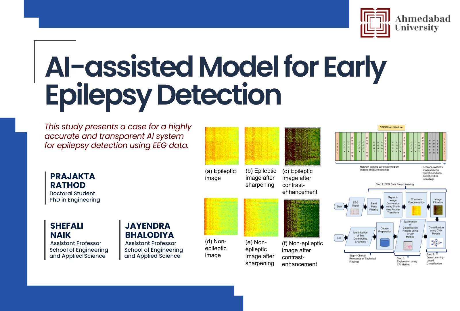 AI-assisted Model for Early Epilepsy Detection