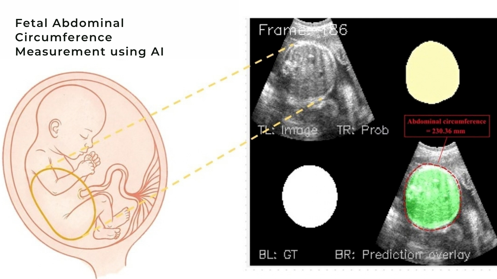 Fetal Growth