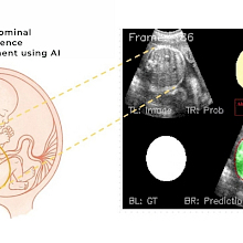 Fetal Growth