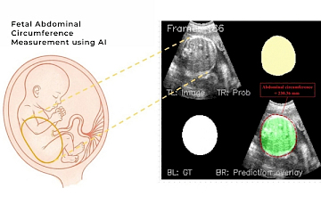 Fetal Growth